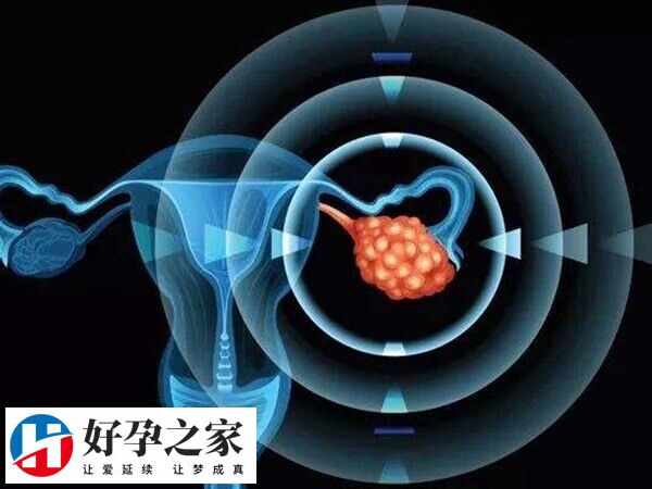 促排為什么越促卵泡越少